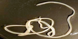 parasit-guinea-worm